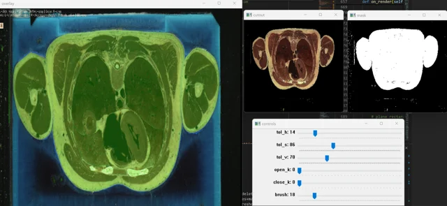 Segmentation of anatomical slices