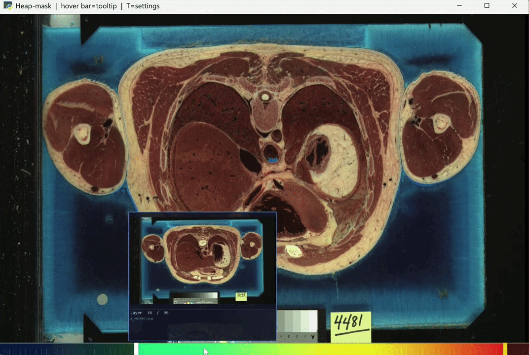 Human Visualization App Top Down Viewer